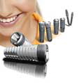 affordable-dental-implants2